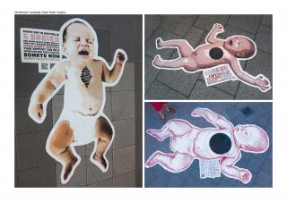 HeartKids WA: StreetHeart open heart surgery